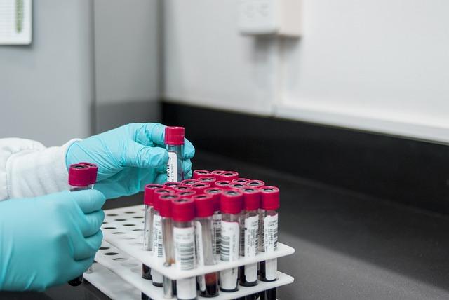 Lab results expected soon in DR Congo’s mystery outbreak – cidrap.umn.edu