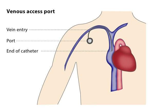 The ⁤Significance of Port Access for Economic development‌ in⁣ the Horn of Africa